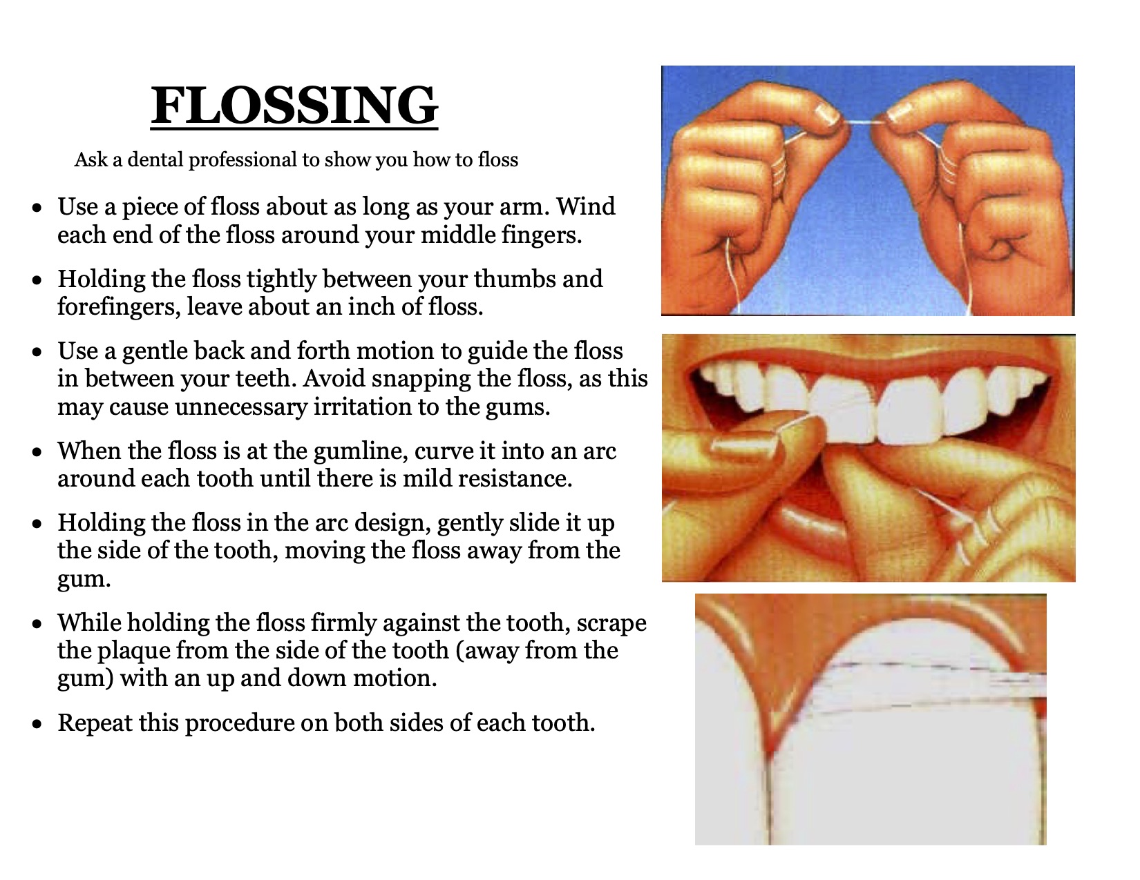 Flossing flyer